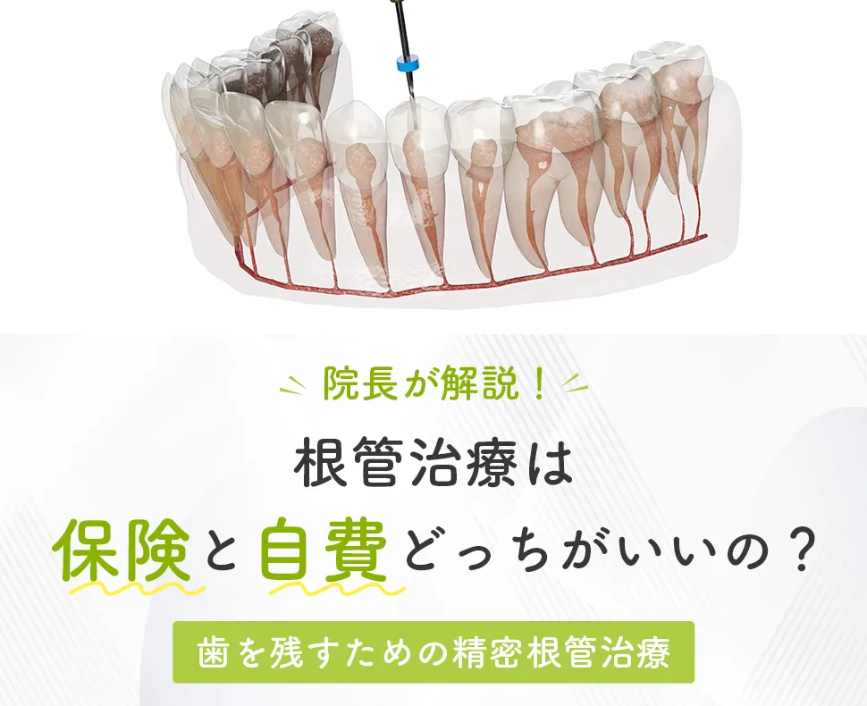 歯を残すための精密根管治療 根管治療は保険と自費どっちがいいの？ 院長が解説！