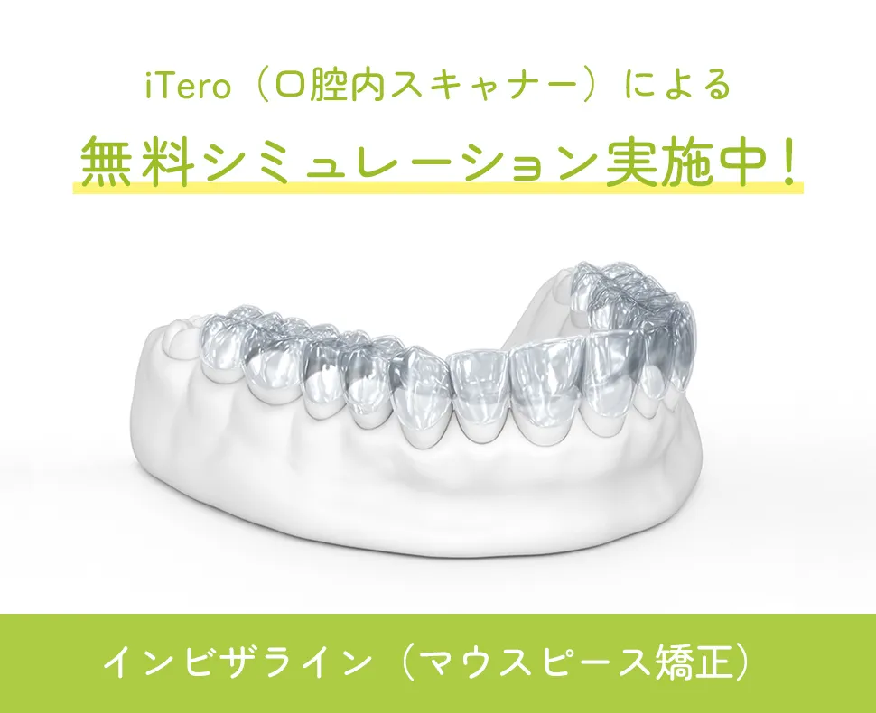 iTero（口腔内スキャナー）による無料シミュレーション実施中！インビザライン（マウスピース矯正）