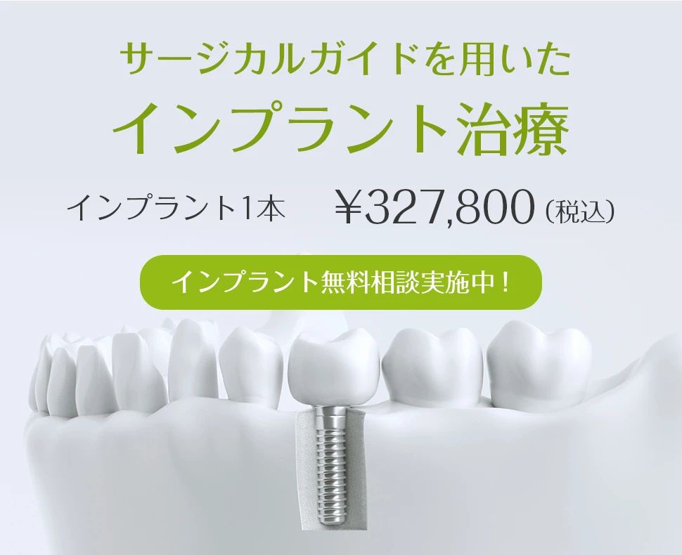 サージカルガイドを用いたインプラント治療 インプラント1本 ¥327,800（税込）インプラント無料相談実施中！