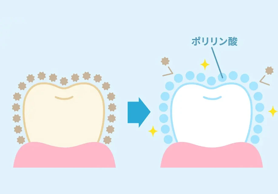 当院のオフィスホワイトニング